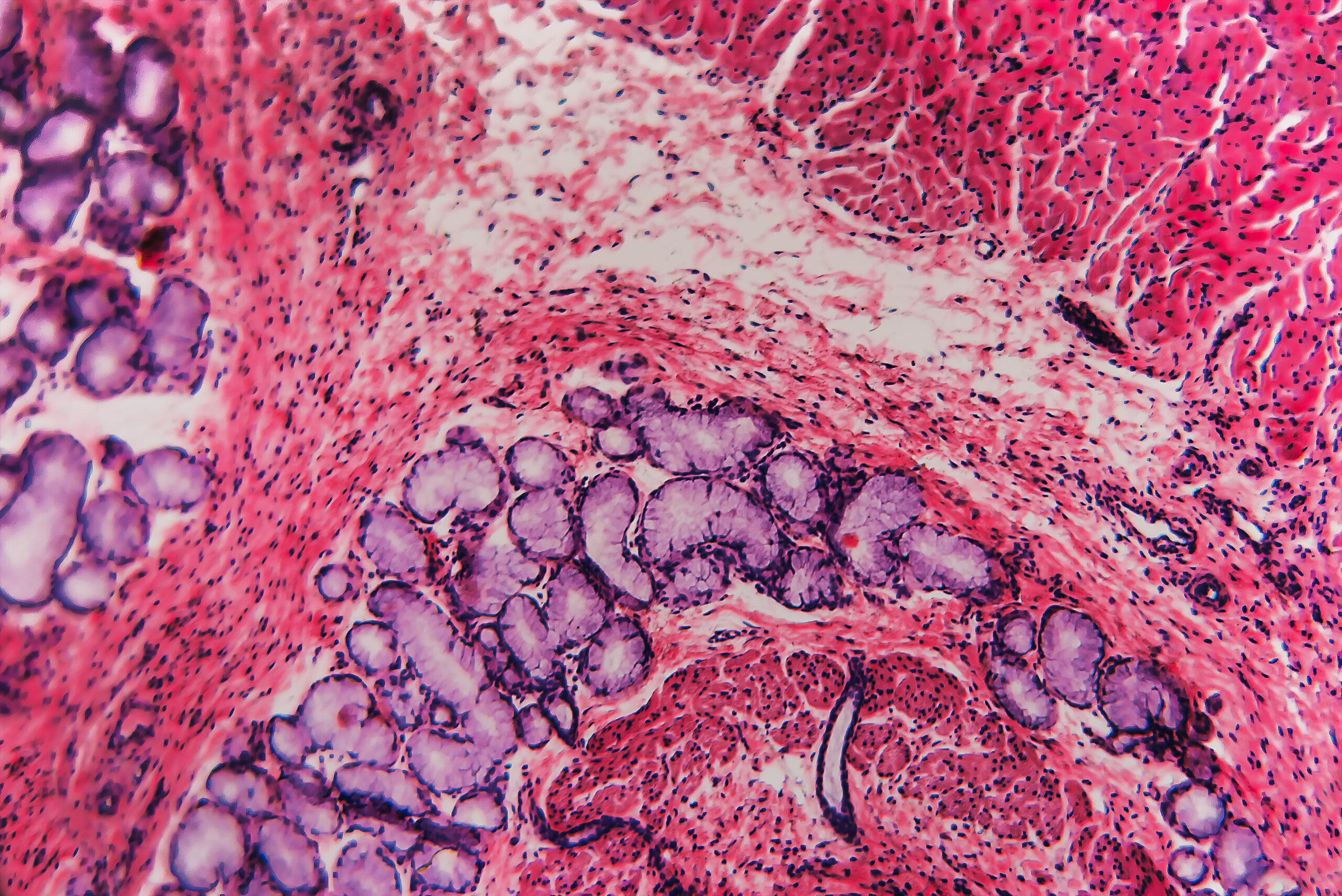 What Is Gastrointestinal GI Cancer in Canines Types Symptoms and Treatment Total Vet Gastrointestinal cancer in dogs Lab image showing GI cancer deterioration